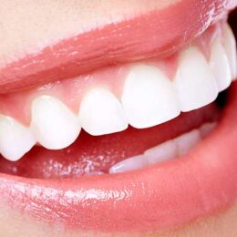 Dentista impianti dentali